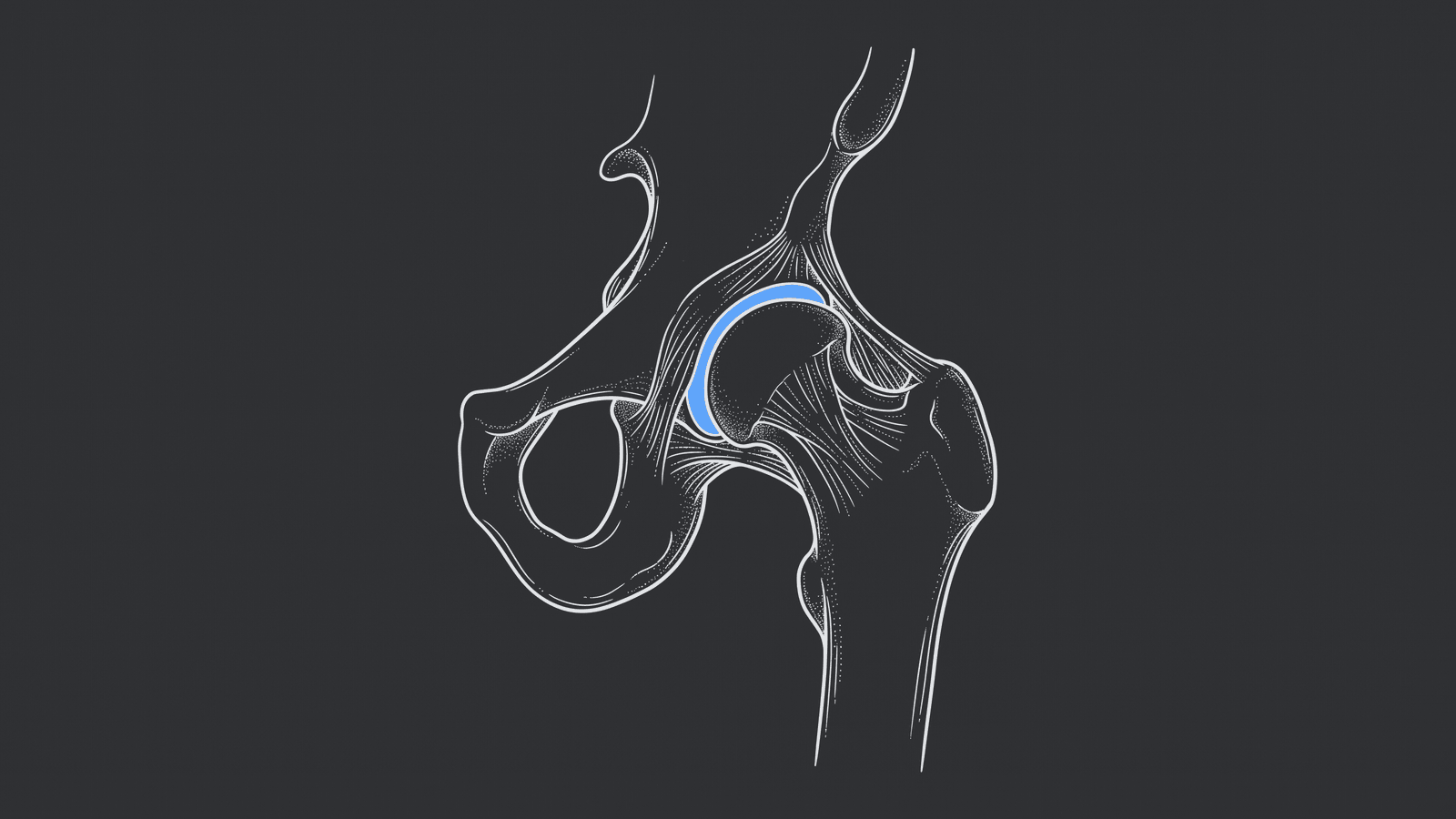 Line illustration of a hip joint